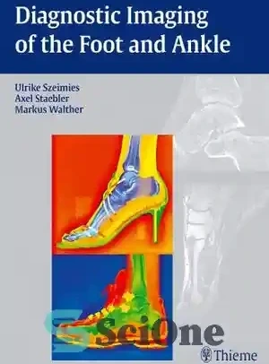 خرید و قیمت دانلود کتاب Diagnostic Imaging of the Foot and Ankle ...