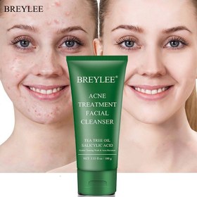 تصویر فوم شستشو صورت تیوپی چای سبز بریلی Breylee facial cleanser