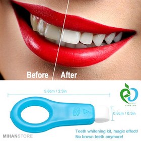 تصویر نانو پد سفید کننده دندان Ovan ا Ovan Teeth Whitening Kit Ovan Teeth Whitening Kit