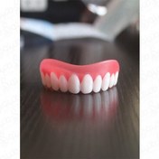 تصویر روکش دندان سفید، لمینت متحرک دندان، طرح و ساخت جدید 