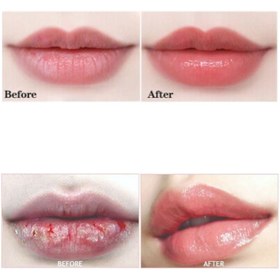 تصویر ماسک لب حبابی کاریته Karite bubble lip mask