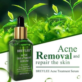 تصویر سرم چای سبز بریلی Acne treatment serum