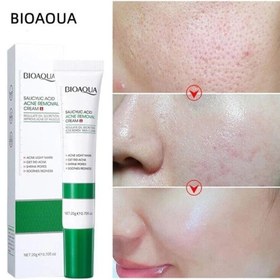 تصویر پک ۵ محصوله ضد جوش سالیسیلیک اسید 