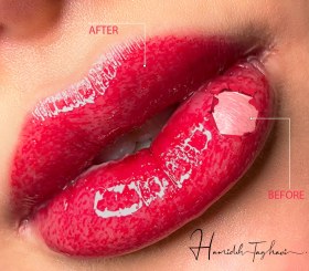 تصویر تینت لب 