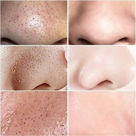 تصویر ماسک بینی لانبنا مدل Nil وزن 5 گرم 