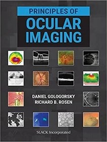 خرید و قیمت دانلود کتاب Clinical OCT Angiography Atlas 2nd Edition | ترب