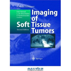 خرید و قیمت دانلود کتاب Imaging of Soft Tissue Tumors | ترب