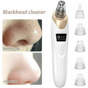 تصویر میکرو درم شارژی Rechargeable microdermabrasion