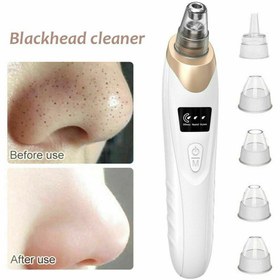 تصویر میکرو درم شارژی Rechargeable microdermabrasion