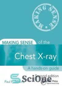 تصویر دانلود کتاب Making Sense of the Chest X-ray: A hands-on guide – ایجاد حس اشعه ایکس قفسه سینه: راهنمای عملی 
