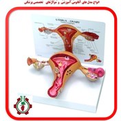 تصویر مولاژ رحم و تخمدان Moulage of the uterus and ovaries