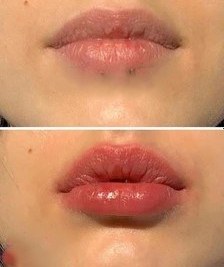 تصویر ماسک خواب (بالم) لب رمانتیک رین اصلی Romantic Rain Lip Mask