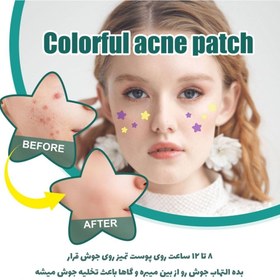 تصویر چسب بینی ضد جوش فانتزی 