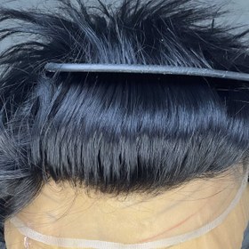 تصویر پروتز موی بالای سر مدل آنکارایی (کد:8026) - آنکارایی ا Men's overhead hair prosthesis(code:8026) Men's overhead hair prosthesis(code:8026)