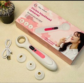 تصویر میکرودرم ذره بینی WG Hing Latitude 