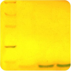 تصویر پروتئین نوترکیب (10nanogram) Smith Ag-۱ 