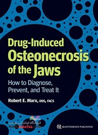 تصویر Drug-Induced Osteonecrosis of the Jawsاستئونکروز فک ناشی از دارو 