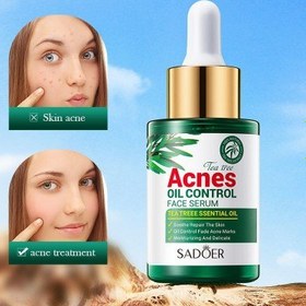 تصویر کرم ضدجوش و آکنه چای سبز سادور tea tree essence cream sadoer