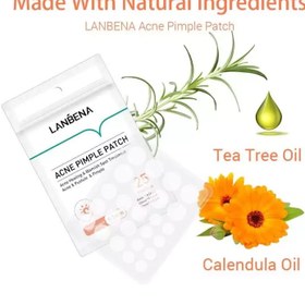 تصویر چسب جوش و آکنه لانبنا بسته 25عددی 