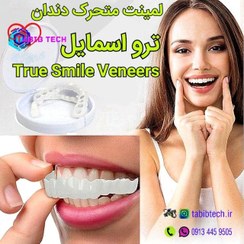 تصویر لمینت متحرک ترو اسمایل True Smile Veneers اصلی(فک‌بالا+فک‌پایین) 