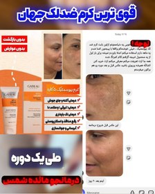 تصویر پک کرم بیوممتیک گاتیو و کرم ویتامین E حجم ۴۰ میلی لیتر 