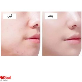 تصویر برس شارژی پاک کننده صورت E608 