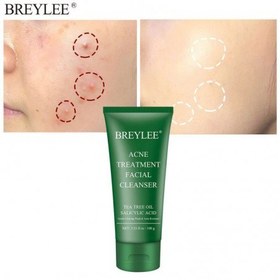 تصویر فوم شستشو ضد جوش 100گرم بریلی Breylee Acne Treatment Facial Cleanser 100g