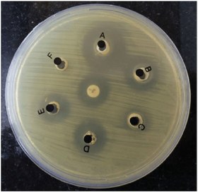 تصویر well آگار دیفیوژن | آگار دیفیوژن به روش چاهک گذاری | تست هاله عدم رشد Agar well diffusion method