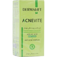 تصویر ژل ضد جوش اورژانسی درمالیفت مدل آکنویت حجم ۱۵ میلی لیتر 