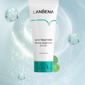 تصویر فوم شستشوی صورت ضد جوش برند لانبنا Lanbena Acne Treatment Facial Cleanser