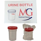 تصویر ظرف نمونه گیری یورین باتل ۶۰ میلی‌لیتر درب پیچی استریل 