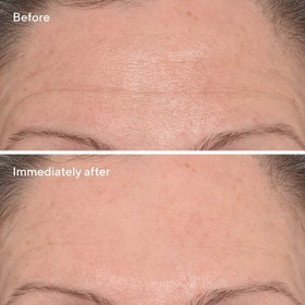 تصویر کرم درمانی کاهنده چین و چروک مورد Targeted Wrinkle Corrector | Murad