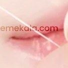 تصویر پک سرم و نخ کلاژن ساز جذبی بدون نیاز به تزریق کره ای ADAD Absorbable serum and collagen thread pack without the need for ADAD Korean injections