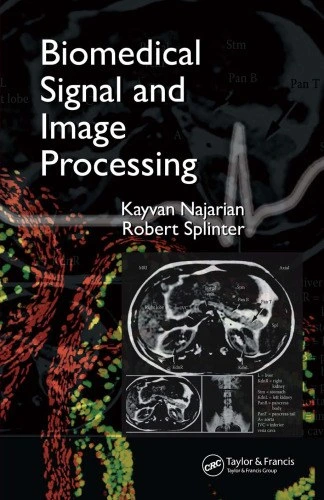 خرید و قیمت دانلود کتاب Biomedical signal and image processing 2006 | ترب