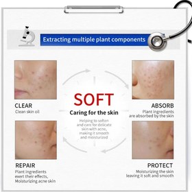 تصویر کرم ضد جوش فوری 