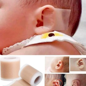 تصویر چسب فرم دهی و اصلاح گوش نوزاد - 