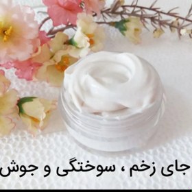 تصویر کرم رفع لک سوختگی جوش و زخم 