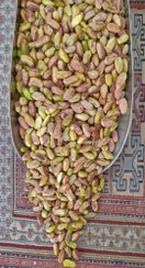 تصویر مغز توآبی اکبری نمونه2 