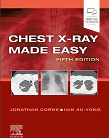 تصویر دانلود كتاب Chest X-Ray Made Easy 5th Edition 