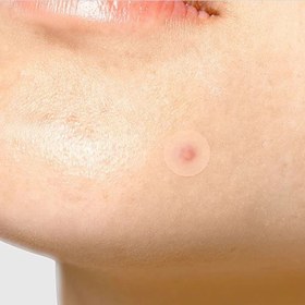 تصویر چسب ضدجوش تیام چسب-ضد-جوش-تیام-TIA'M