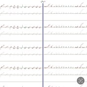 تصویر سرمشق درس اول خوشنویسی با خودکار مقدماتی (نستعلیق) 
