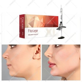 تصویر ژل فیوریج Fiorage XL 