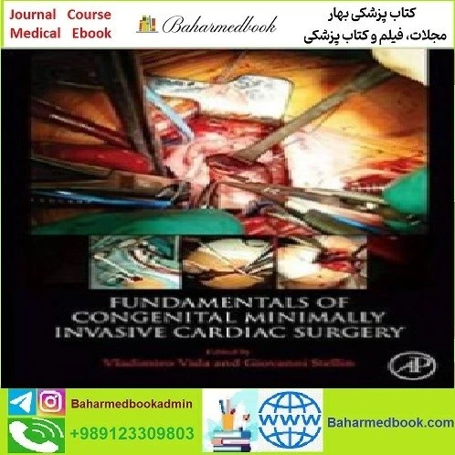 Fundamentals of Cardiovascular Surgery