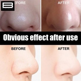 تصویر چسب بینی ویت بسته 6 عددی 