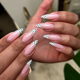 تصویر کاشت اولیه ژل 