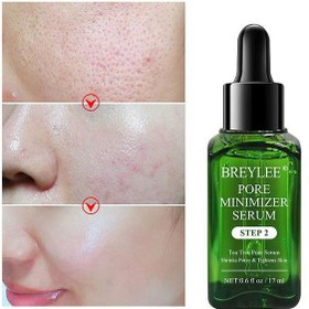 تصویر چسب ضد جوش مدل Step1 حجم 17میل بریلی Breylee Black Head Mask Step1 17ml