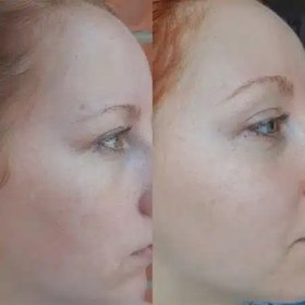 تصویر کرم افکلار K + لاروش پوزای La Roche-Posay Effaclar K + Creme