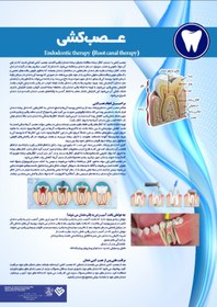 تصویر پوستر عصب کشی دندان - مجموعه پوسترهای دندانپزشکی (آموزش بیمار) 