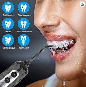 تصویر واترجت شست و شوی دهان و دندان INSMART با مخزن 300 میلی لیتری قابل حمل Cordless Water Dental Flosser Teeth Cleaner, INSMART Professional 300ML Tank DIY Mode USB Rechargeable Dental Oral Irrigator for Home and Travel, IPX7 Waterproof 6 Modes Irrigate for Oral Care