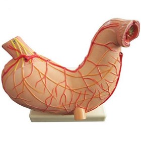 تصویر مولاژ معده 